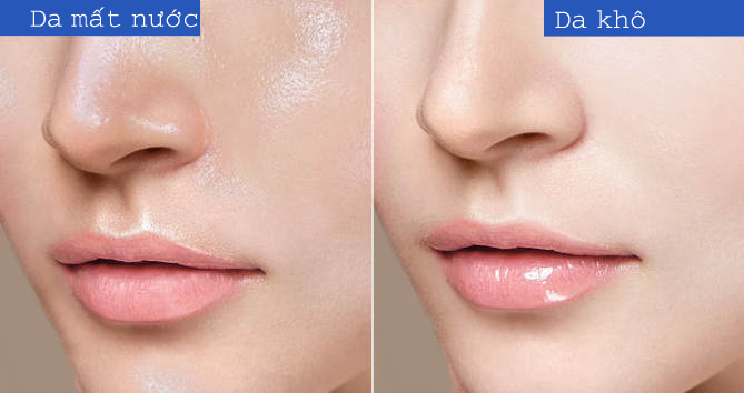 DA MẤT NƯỚC VÀ DA KHÔ: 7 MẸO HÀNG ĐẦU ĐỂ CUNG CẤP NƯỚC CHO DA 1 da mat nuoc da kho