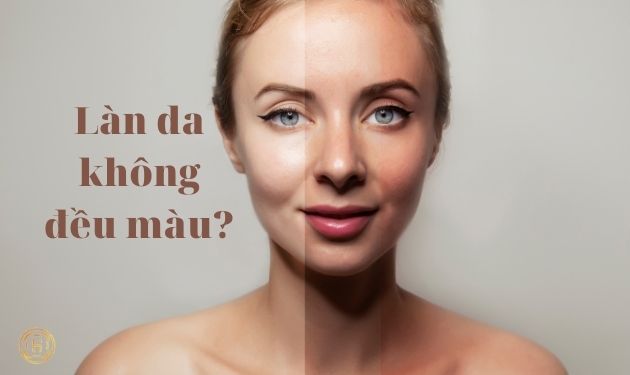 CÁCH KHẮC PHỤC LÀN DA KHÔNG ĐỀU MÀU VÀ LẤY LẠI VẺ TƯƠI SÁNG 1 lan da khong deu mau