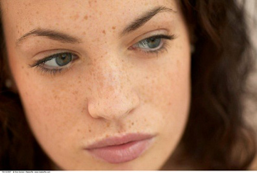 Nguyên nhân da sạm đen và cách khắc phục 1 tri nam da mat