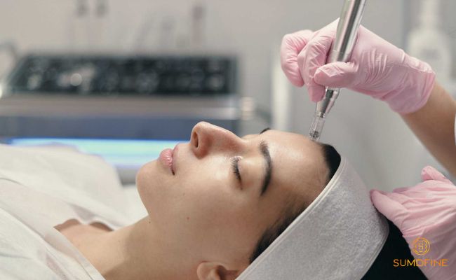 Microneedling kết hợp PRP