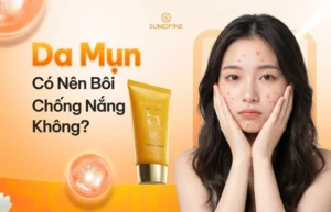 Da mụn có nên dùng Kem chống nắng?
