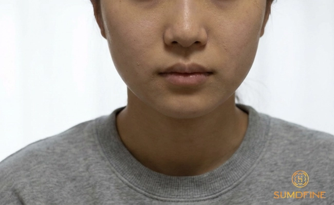 7 lý do bắt buộc phải thoa kem chống nắng và mùa đông để bảo vệ da 5 Tác hại ngắn hạn khi không dùng kem chống nắng vào mùa đông