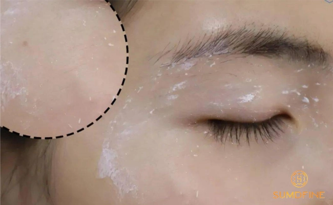 6 Tác hại của kem chống nắng khi dùng sai cách & Cách phòng tránh hiệu quả 8 Tránh sử dụng kem chống nắng hết hạn, kem chống nắng giả, không đạt chuẩn