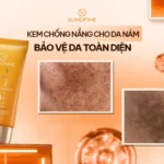 TOP 8 kem chống nắng cho da nám không nên bỏ qua năm 2026