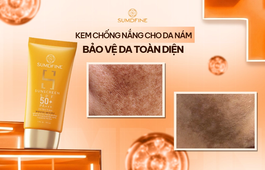 TOP kem chống nắng cho da nám