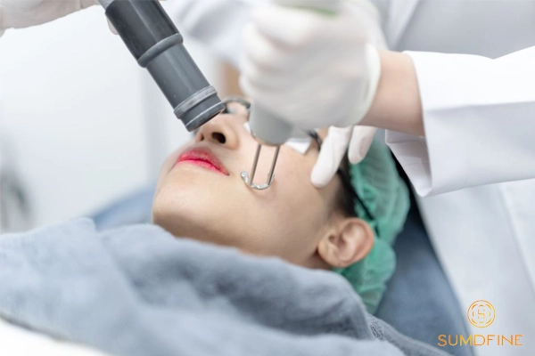 Laser pico trị nám trung bì