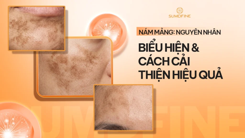 Nám mảng là gì?