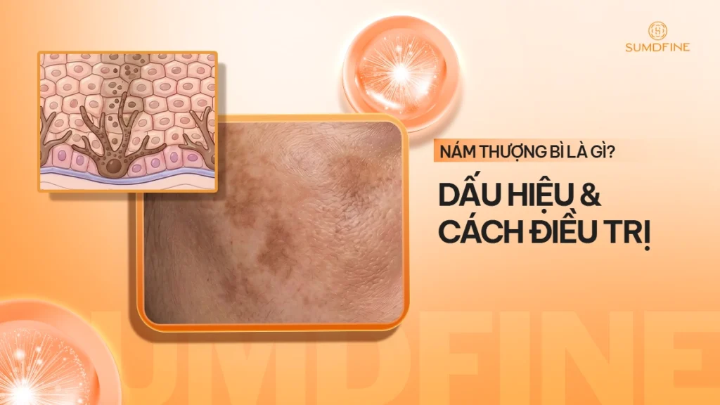 Nám thượng bì
