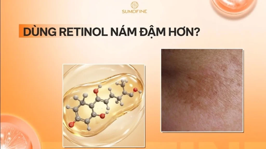 5 Lý do khiến nám da đậm hơn sau khi dùng Retinol & Cách xử lý 1 Dùng retinol nám đậm hơn