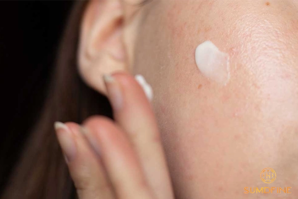 Trị nám thượng bì tại nhà