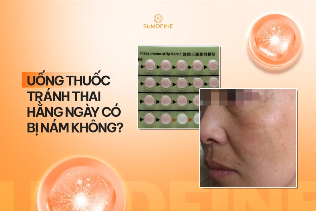 Uống thuốc tránh thai hằng ngày có bị nám không? 1 Uống thuốc tránh thai hằng ngày có bị nám không?