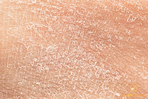 Serum B5 kết hợp với kem dưỡng nào? Gợi ý 4 lựa chọn tối ưu 3 Da khô nên dùng kem dưỡng gì cùng B5