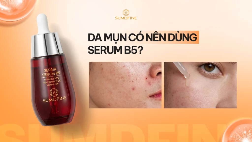 Da mụn có nên dùng serum b5