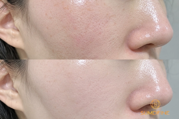 Cách dùng serum B5 giúp dưỡng ẩm, làm dịu và phục hồi hiệu quả 4 Dùng serum B5 bao lâu thì thấy hiệu quả?