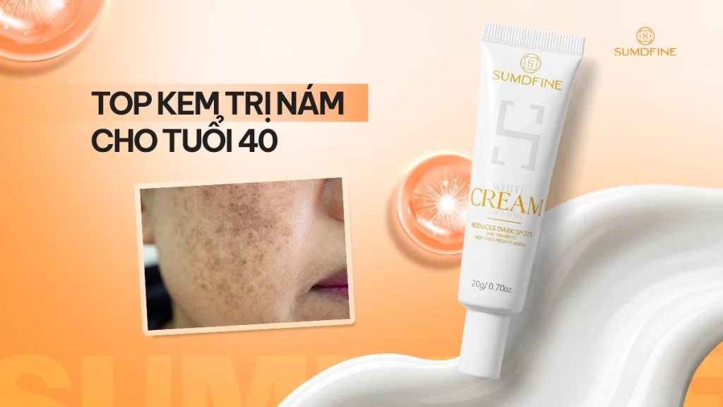 Review top kem trị nám cho phụ nữ tuổi 40 (U50)