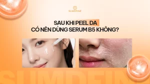 Peel da có nên dùng serum B5