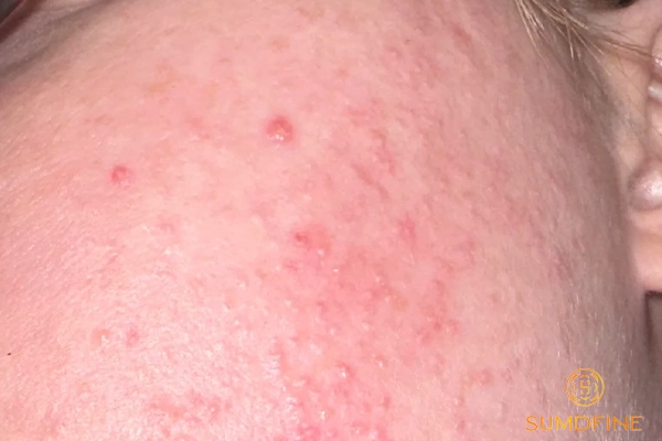 Quay trở lại quy trình skincare