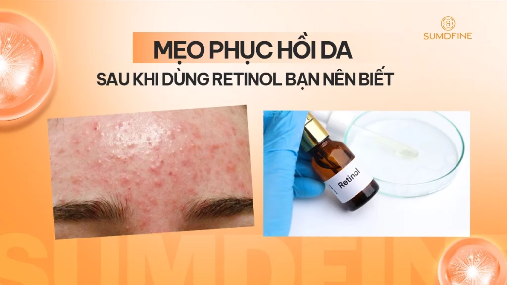 TOP Serum phục hồi da khi dùng retinol