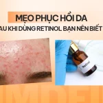 TOP 5 Serum Phục Hồi Da Khi Dùng Retinol Hiệu Quả 2026
