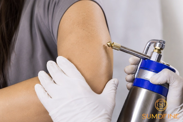 Nhận diện và xử lý nám da tay hiệu quả tại nhà & tại phòng khám 5 Cryotherapy trị nám da tay