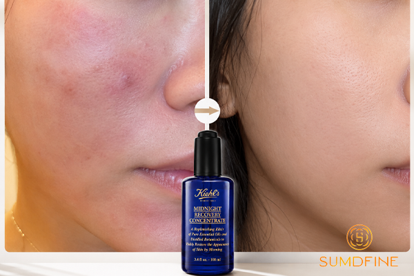 Top 5 Serum B5 Phục Hồi Da Sau Lăn Kim 2026 Bác Sĩ Da Liễu Khuyên Dùng 5 Kiehl's Midnight Recovery Concentrate serum b5 phục hồi da sau lăn kim