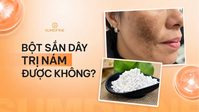 Thực hư chuyện uống bột sắn dây trị nám: Dùng như nào đúng cách?