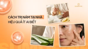 Cách trị nám tại nhà hiệu quả