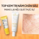 Review TOP 5 kem trị nám chân sâu 2026: Loại nào thực sự hiệu quả?