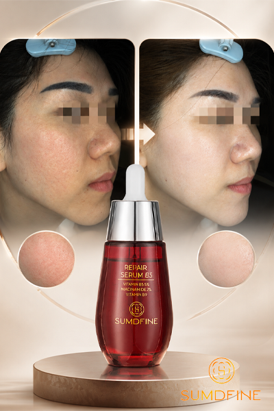 TOP 7 hoạt chất phục hồi da tốt nhất (theo từng vấn đề da) 1 Hoạt chất phục hồi da pathenol - vitamin B5
