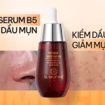 Top 7 serum B5 cho da dầu mụn được cộng đồng skincare tin tưởng 2026