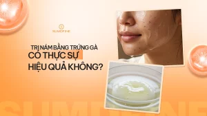Trị nám bằng trứng gà: Có thực sự hiệu quả hay chỉ là truyền miệng? 4 Trị nám bằng trứng gà có hiệu quả không