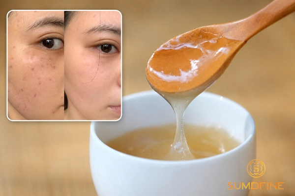Uống bột sắn dây trị nám có hiệu quả không?