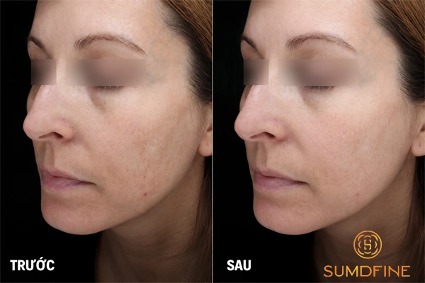 SkinCeuticals Discoloration Defense - kem trị nám hiệu quả