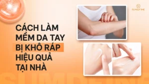 Các cách làm mềm da tay bị khô rát hiệu quả