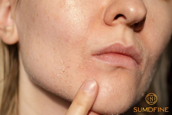 Tiêu chí lựa chọn serum cho da khô bong tróc