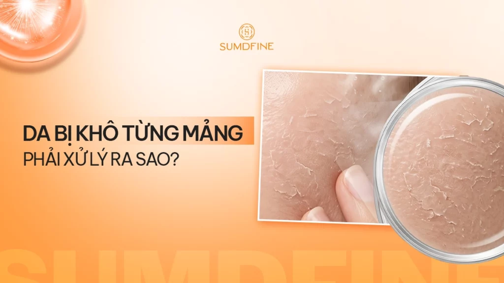 Tình trạng da khô từng mảng