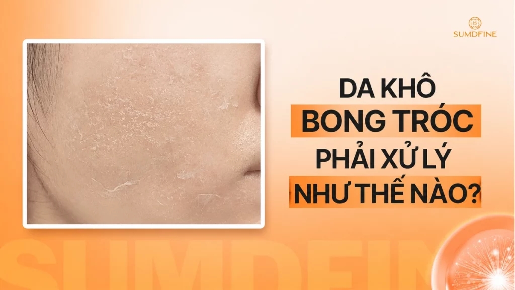 Tình trạng Da khô bong tróc