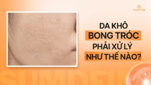 Tình trạng Da khô bong tróc