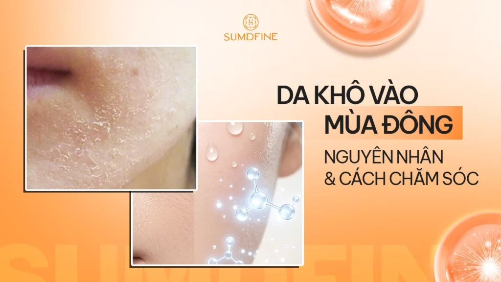 Bị khô da vào mùa đông là tình trạng gì? Xử lý ra sao?
