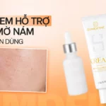 Top 12 kem trị nám được bác sĩ da liễu khuyên dùng năm 2026