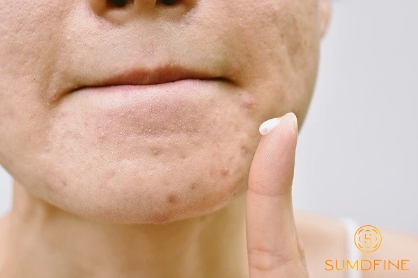 Khoá ẩm bằng kem dưỡng là bước không thể thiếu