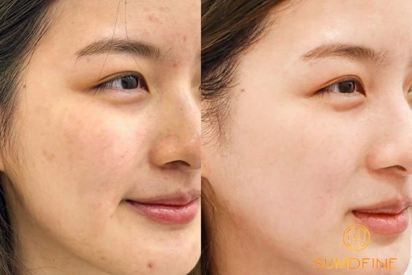 Serum B5 loại nào tốt? Top 8 serum B5 cấp ẩm và phục hồi đáng dùng 2026 1 Serum B5 đem lại công dụng cấp ẩm phục hồi hiệu quả