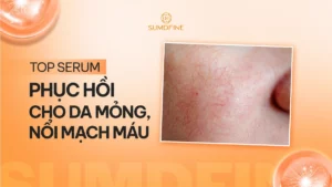 Review serum giúp phục hồi da mỏng bị nổi mạch máu