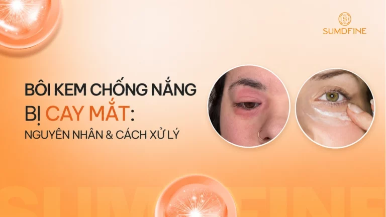 Bôi kem chống nắng cay mắt: Nguyên nhân & cách xử lý nhanh