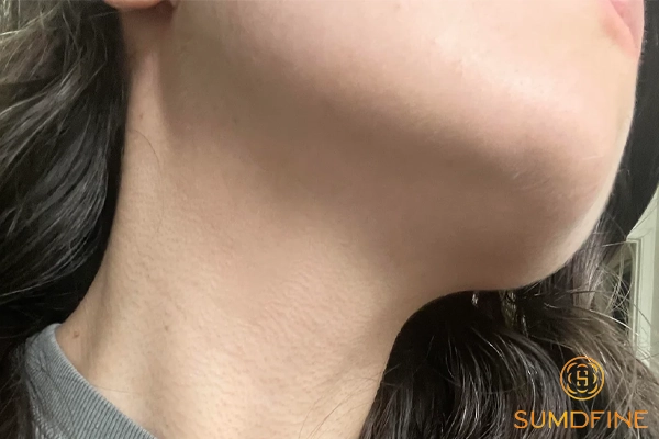 8 vị trí thường bị bỏ quên khi bôi kem chống nắng 5 Vùng da khu vực dưới hàm