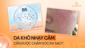 Hướng dẫn chăm sóc cho da khô nhạy cảm