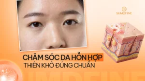 Chăm sóc da hỗn hợp thiên khô hiệu quả tại nhà
