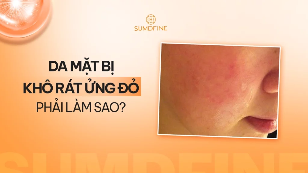 Da mặt bị khô đỏ, hơi rát: Nguyên nhân & Cách xử lý cho từng trường hợp 1 Da mặt bị khô đỏ rát là do đâu?