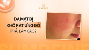 Da mặt bị khô đỏ rát là do đâu?