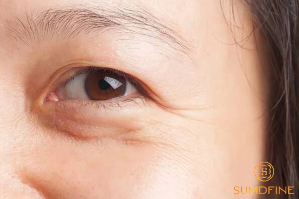 Nguy cơ lão hoá nếu không thoa kem chống nắng cho da vùng mắt